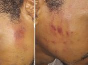 O estranho silêncio das instituições de Direitos Humanos, em Alagoas, sobre a agressão dos 20 PMs, em formação, a três jovens pretos, em Maceió