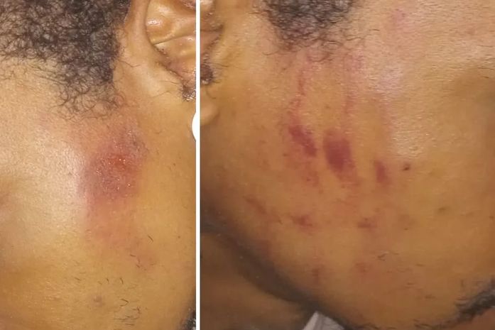 O estranho silêncio das instituições de Direitos Humanos, em Alagoas, sobre a agressão dos 20 PMs, em formação, a três jovens pretos, em Maceió