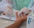 Testagem para HIV é oferecida diariamente nas unidades de saúde