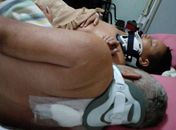 Alagoanos vítimas de acidente em Minas Gerais conseguem transferência para tratamento médico no Estado