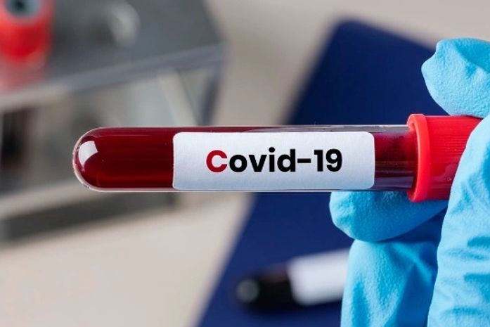 Covid-19: Alagoas confirma 476 novos casos e 14 mortes nesta quarta-feira; vítimas tinham entre 42 e 85 anos