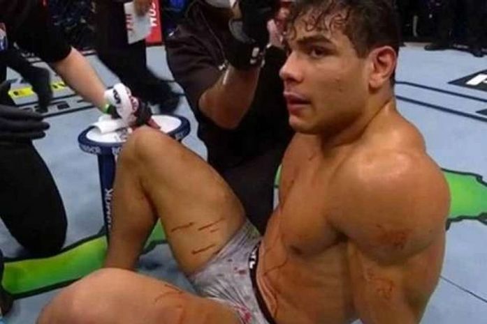 Borrachinha revelou ter tomado vinho antes da luta contra Adesanya