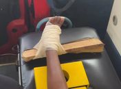 Menina de 10 anos é encaminhada ao HEA após ficar ferida enquanto pulava no sofá; veja vídeo