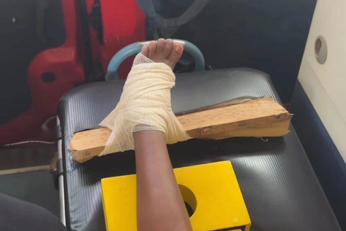 Menina de 10 anos é encaminhada ao HEA após ficar ferida enquanto pulava no sofá; veja vídeo