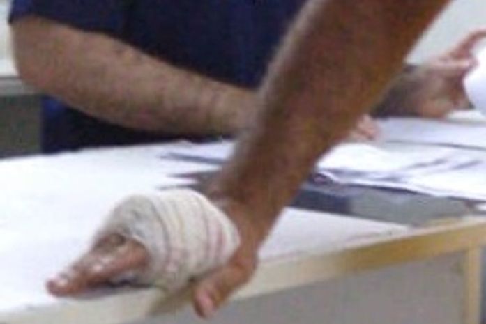 Militar foi baleado na mão durante assalto na parte alta de Maceió