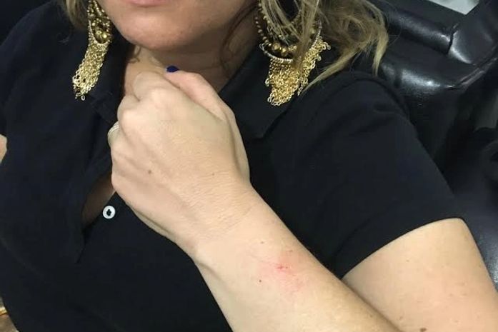 Vereador agride prefeito e primeira dama de Palmeira dos Índios