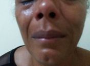 Atleta alagoana afirma ter sido espancada por policiais militares no Tabuleiro