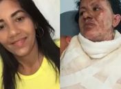 Qual a pena justa para um homem que agrediu, ateou fogo e aprisionou por 24h sua própria mulher?