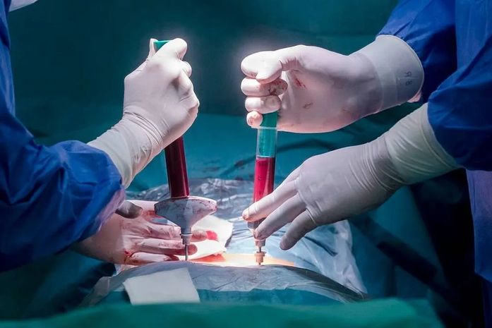 Existe limite para doar medula óssea? Entenda o procedimento para doação e quais as dificuldades para encontrar doadores