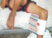 Vítimas são dois irmãos, de 10 e 11 anos, e um tio deles de 14 anos.