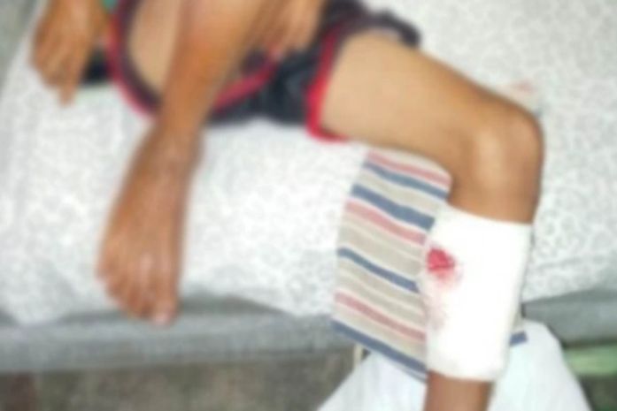 Vítimas são dois irmãos, de 10 e 11 anos, e um tio deles de 14 anos.