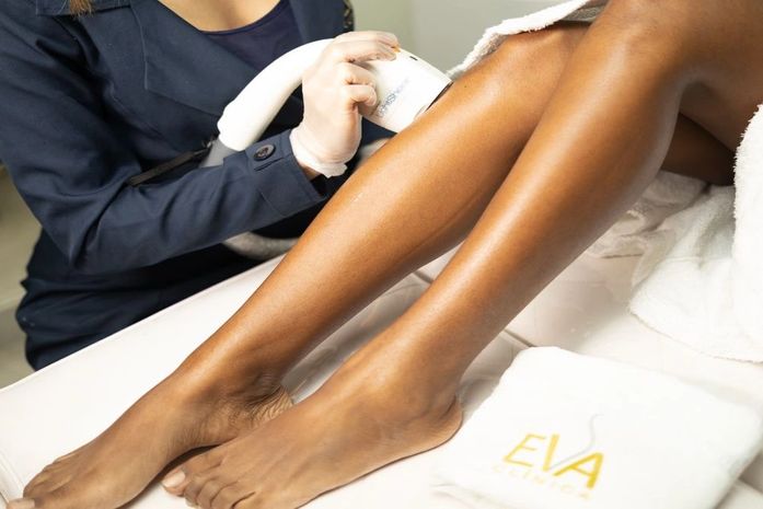 Por que investir em depilação a laser? 5 motivos!