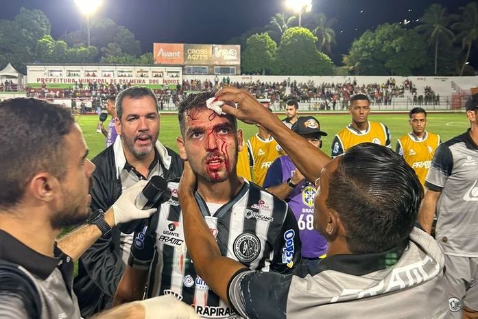 Agressão de torcedor do CSE a jogador do ASA penaliza em 60 dias de jogos a portões fechados