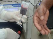 Quer doar sangue durante o Carnaval? Veja os horários de funcionamento do Hemoal
