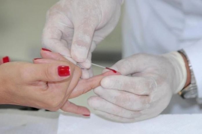 Sesau vai capacitar municípios para realização do Teste Rápido de HIV e sífilis