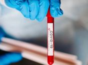 Alagoas registra 142 novas infecções e oito óbitos por Covid-19 nas últimas 24h