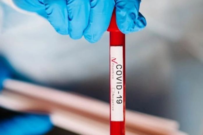 Covid: Brasil registra 401 novas mortes e média móvel abaixo de 400