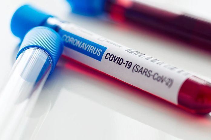 Dos 102 municípios alagoanos, 39 registraram novos casos da covid-19 na última semana