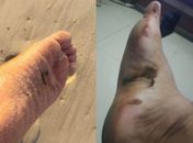 Novas manchas de óleo são encontradas em praias do Litoral Sul de Alagoas