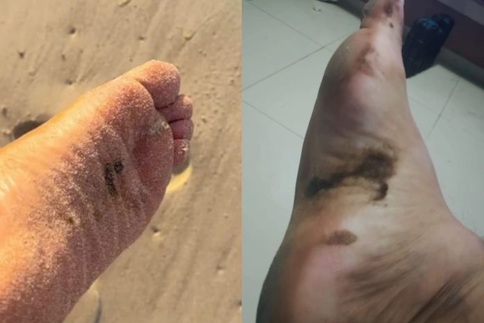 Novas manchas de óleo são encontradas em praias do Litoral Sul de Alagoas