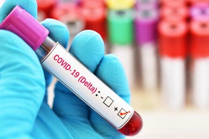 Nas últimas 24 horas, Alagoas registrou mais 66 casos e duas mortes por Covid-19