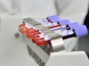 Hemoal cadastra doadores de medula óssea no Cesmac nesta sexta (15)