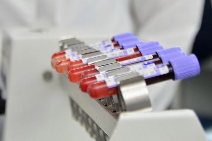 Hemoal cadastra doadores de medula óssea no Cesmac nesta sexta (15)