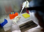 Covid-19: pesquisadores analisam eficácia da cloroquina