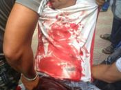 PM baleado durante tentativa de assalto