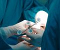 Robótica na ortopedia e segurança hospitalar ganham destaque na HospitalMed, em Pernambuco
