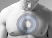 Homens representam 1% do total de casos de câncer de mama no Brasil