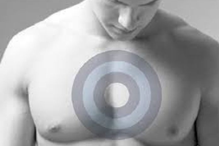 Homens representam 1% do total de casos de câncer de mama no Brasil