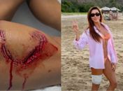 Turista é mordida por tubarão durante mergulho em Fernando de Noronha