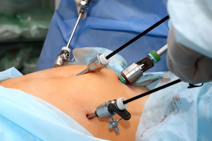 Menos de 1% dos brasileiros com indicação para bariátrica conseguem operar — e o plano de saúde pode ser um dos obstáculos