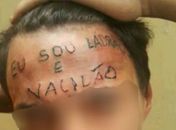 “Ladrão e vacilão”: jovem que teve frase tatuada na testa é preso novamente