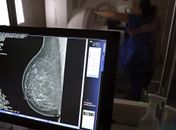Plano de saúde terá que cobrir mamografia digital para todas as idades