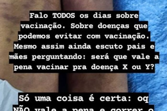 Bebê de um ano morre por suspeita de Meningite, em Maceió