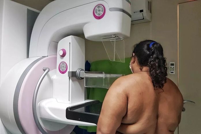 Delmiro Gouveia realiza mutirão de mamografias até a próxima quinta-feira, 10