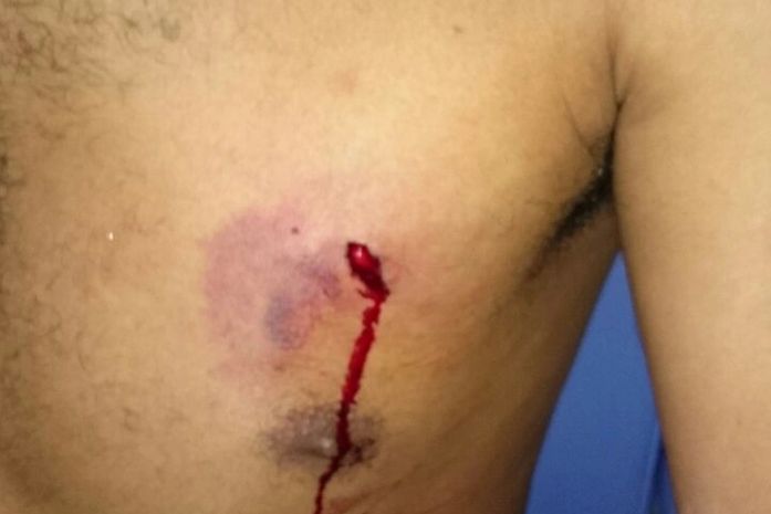 Tiro atingiu o peito do agente penitenciário