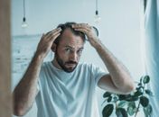 Conheça 6 tipos de alopecia e seus possíveis tratamentos
