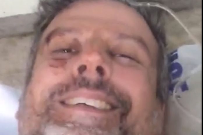 Zé Emílio Dantas, vítima de atentado em Batalha, grava vídeo para mostrar que está bem