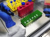 Proporção da população com anticorpos do novo coronavírus aumenta 53%