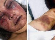 Mãe do lutador Rayron Gracie é espancada brutalmente no Rio: "Um monstro"