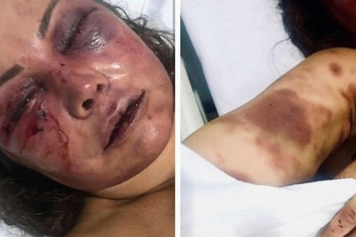 Mãe do lutador Rayron Gracie é espancada brutalmente no Rio: "Um monstro"