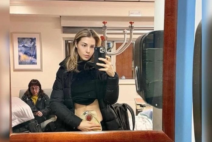 Transplante de fezes do namorado faz mulher ter sintomas de depressão