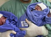 Trigêmeos nascem de parto humanizado no Hospital Regional de Arapiraca