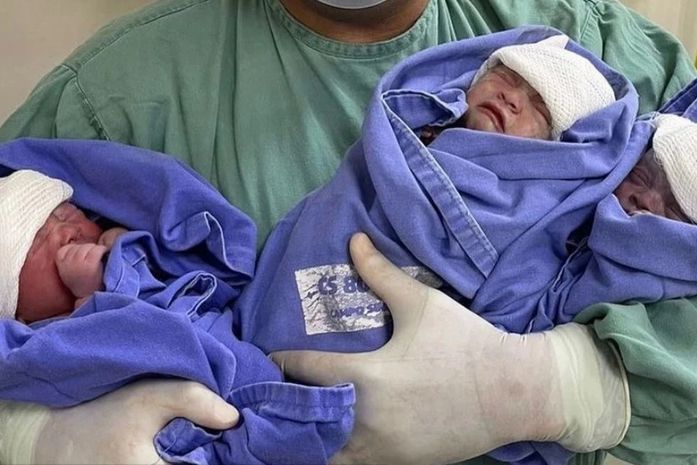 Trigêmeos nascem de parto humanizado no Hospital Regional de Arapiraca