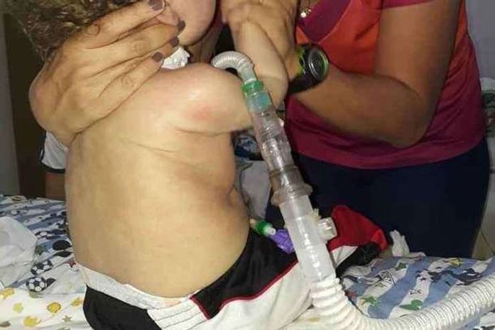 João Miguel tinha Atrofia Muscular Espinhal (AME), doença responsável pela perda dos neurônios motores.