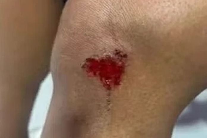 Homem é preso após empurrar companheira de carro em movimento em Maceió