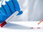 Boletim da Sesau registra 1.063 novos casos de Covid-19 em Alagoas